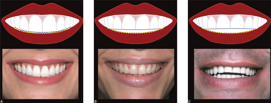 dental-patients-faqs-tha-palisades-dentists