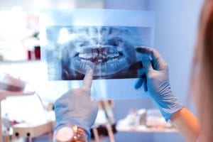 dental x-ray examination